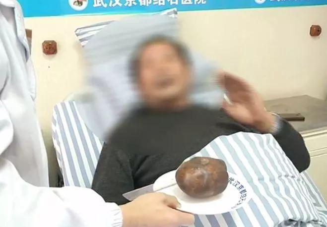 实测分享“天天爱柳州麻将有挂”(原来真的有挂)-知乎 