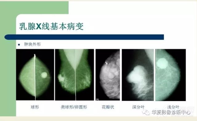 三分钟了解&quot;x光透视设备具生产厂家“推荐2个购买渠道